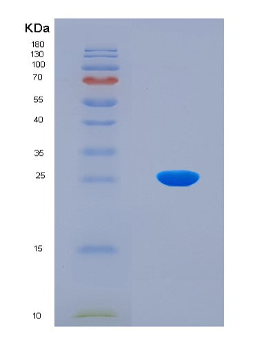 SDS-PAGE analysis of Human KAT2B (Histone Acetyltransferase Kat2B) - Recombinant Protein, CATHuman KAT2B (Histone Acetyltransferase Kat2B) - Recombinant Protein