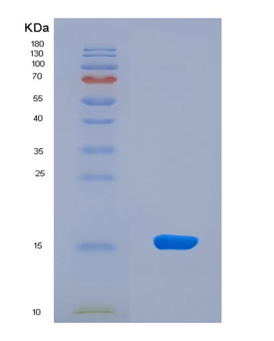 SDS-PAGE analysis of Human S1PR1 (Sphingosine 1-Phosphate Receptor 1) - Recombinant Protein, CAT# BLT-08551P showing >90% purity under 15% SDS-PAGE (Reduced)Human S1PR1 (Sphingosine 1-Phosphate Receptor 1) - Recombinant Protein