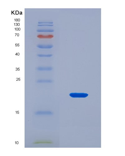 SDS-PAGE analysis of Human SLC5A1 (Sodium/Glucose Cotransporter 1) - Recombinant Protein, CATHuman SLC5A1 (Sodium/Glucose Cotransporter 1) - Recombinant Protein