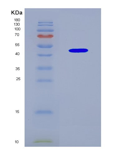 SDS-PAGE analysis of Human TMPRSS4 (Transmembrane Protease Serine 4) - Recombinant Protein, CATHuman TMPRSS4 (Transmembrane Protease Serine 4) - Recombinant Protein