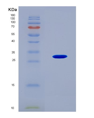 SDS-PAGE analysis of Human RNF123 (E3 Ubiquitin-Protein Ligase Rnf123) - Recombinant Protein, CATHuman RNF123 (E3 Ubiquitin-Protein Ligase Rnf123) - Recombinant Protein