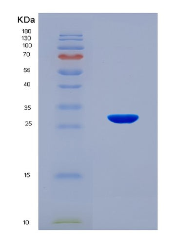 SDS-PAGE analysis of Human RNF123 (E3 Ubiquitin-Protein Ligase Rnf123) - Recombinant Protein, CAT# BLT-08558P showing >90% purity under 15% SDS-PAGE (Reduced)Human RNF123 (E3 Ubiquitin-Protein Ligase Rnf123) - Recombinant Protein