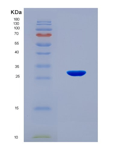 SDS-PAGE analysis of Human RNF123 (E3 Ubiquitin-Protein Ligase Rnf123) - Recombinant Protein, CATHuman RNF123 (E3 Ubiquitin-Protein Ligase Rnf123) - Recombinant Protein