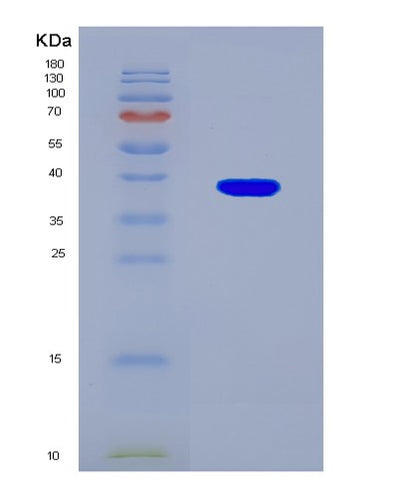 SDS-PAGE analysis of Human PRPS1 (Ribose-Phosphate Pyrophosphokinase 1) - Recombinant Protein, CAT# BLT-08559P showing >90% purity under 15% SDS-PAGE (Reduced)Human PRPS1 (Ribose-Phosphate Pyrophosphokinase 1) - Recombinant Protein