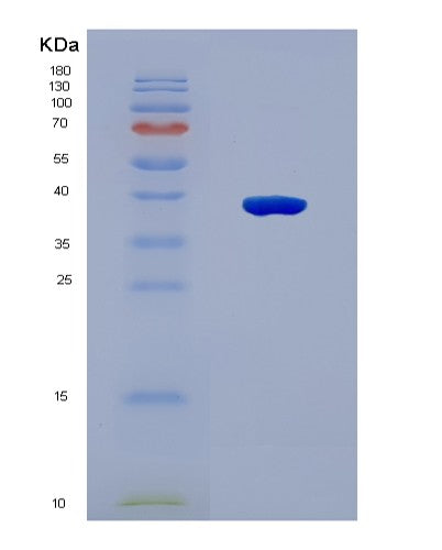 SDS-PAGE analysis of Human PRPS2 (Ribose-Phosphate Pyrophosphokinase 2) - Recombinant Protein, CATHuman PRPS2 (Ribose-Phosphate Pyrophosphokinase 2) - Recombinant Protein