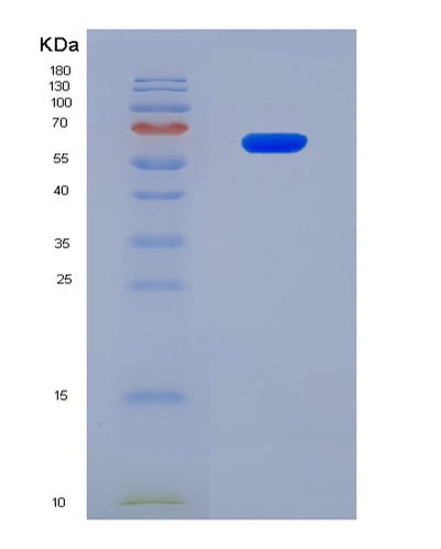 SDS-PAGE analysis of Human DLL3 (Delta-Like Protein 3) - Recombinant Protein, CAT# BLT-08564P showing >90% purity under 15% SDS-PAGE (Reduced)Human DLL3 (Delta-Like Protein 3) - Recombinant Protein