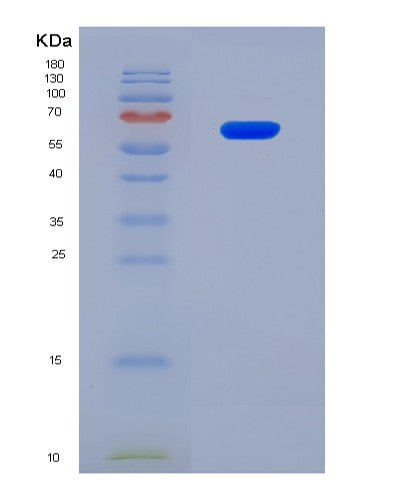SDS-PAGE analysis of Human DLL3 (Delta-Like Protein 3) - Recombinant Protein, CATHuman DLL3 (Delta-Like Protein 3) - Recombinant Protein