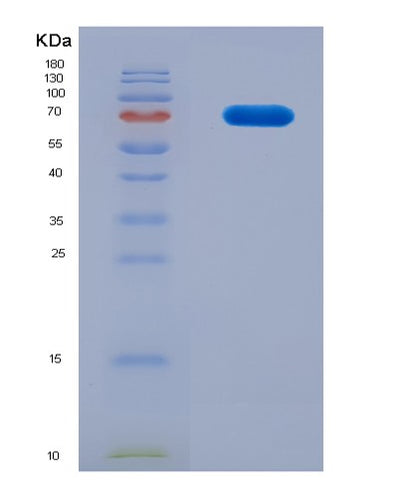 SDS-PAGE analysis of Mouse Hspa9 (Stress-70 Protein, Mitochondrial) - Recombinant Protein, CAT# BLT-08566P showing >90% purity under 15% SDS-PAGE (Reduced)Mouse Hspa9 (Stress-70 Protein, Mitochondrial) - Recombinant Protein