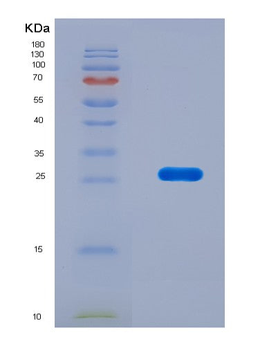 SDS-PAGE analysis of Mouse Glud1 (Glutamate Dehydrogenase 1, Mitochondrial) - Recombinant Protein, CATMouse Glud1 (Glutamate Dehydrogenase 1, Mitochondrial) - Recombinant Protein