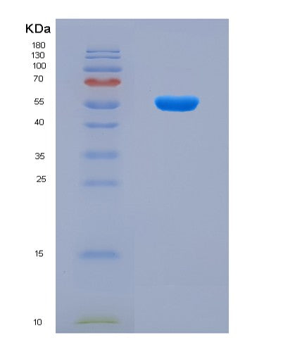 SDS-PAGE analysis of Human TRIM38 (E3 Ubiquitin-Protein Ligase Trim38) - Recombinant Protein, CATHuman TRIM38 (E3 Ubiquitin-Protein Ligase Trim38) - Recombinant Protein