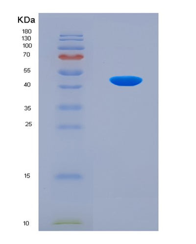 SDS-PAGE analysis of Human DMKN (Dermokine) - Recombinant Protein, CAT# BLT-08571P showing >90% purity under 15% SDS-PAGE (Reduced)Human DMKN (Dermokine) - Recombinant Protein