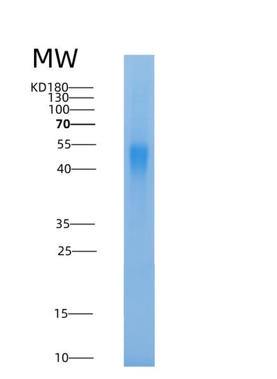 SDS-PAGE analysis of Human PPT2 (Lysosomal Thioesterase Ppt2) - Recombinant Protein, CAT# BLT-08574P showing >90% purity under 15% SDS-PAGE (Reduced)Human PPT2 (Lysosomal Thioesterase Ppt2) - Recombinant Protein