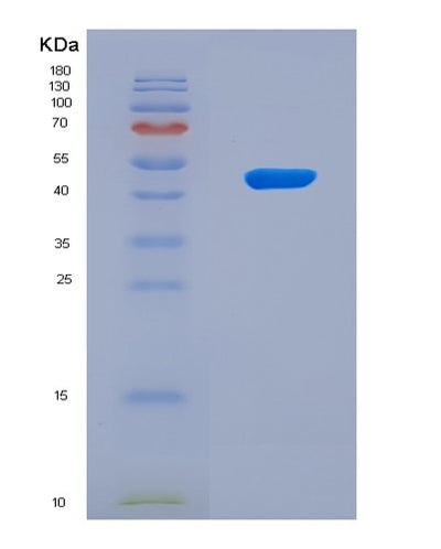 SDS-PAGE analysis of Human FOXO3 (Forkhead Box Protein O3) - Recombinant Protein, CAT# BLT-08575P showing >90% purity under 15% SDS-PAGE (Reduced)Human FOXO3 (Forkhead Box Protein O3) - Recombinant Protein