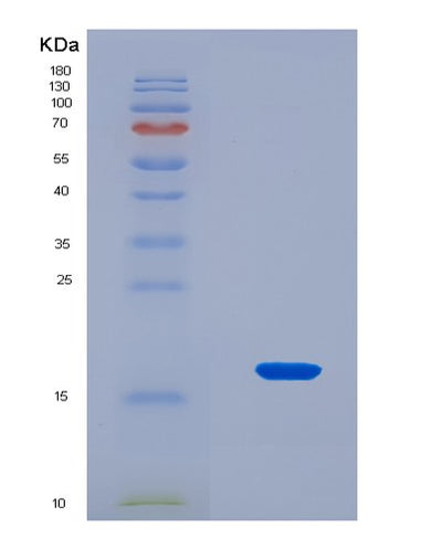 SDS-PAGE analysis of Human FIS1 (Mitochondrial Fission 1 Protein) - Recombinant Protein, CAT# BLT-08576P showing >90% purity under 15% SDS-PAGE (Reduced)Human FIS1 (Mitochondrial Fission 1 Protein) - Recombinant Protein
