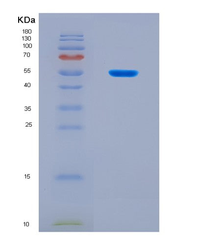 SDS-PAGE analysis of Human FXR1 (Rna-Binding Protein Fxr1) - Recombinant Protein, CATHuman FXR1 (Rna-Binding Protein Fxr1) - Recombinant Protein