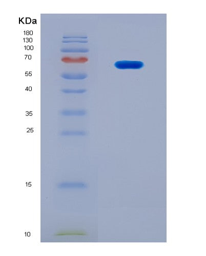SDS-PAGE analysis of Human FARSA (Phenylalanine--Trna Ligase Alpha Subunit) - Recombinant Protein, CATHuman FARSA (Phenylalanine--Trna Ligase Alpha Subunit) - Recombinant Protein
