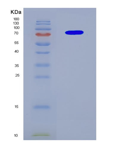 SDS-PAGE analysis of Human CUL3 (Cullin-3) - Recombinant Protein, CAT# BLT-08580P showing >90% purity under 15% SDS-PAGE (Reduced)Human CUL3 (Cullin-3) - Recombinant Protein