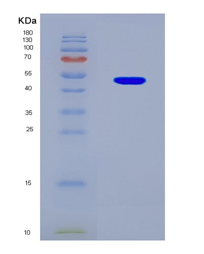 SDS-PAGE analysis of Human E2F1 (Transcription Factor E2F1) - Recombinant Protein, CATHuman E2F1 (Transcription Factor E2F1) - Recombinant Protein