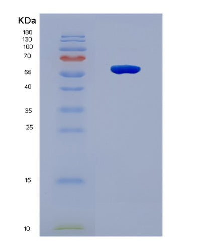 SDS-PAGE analysis of Human RGS6 (Regulator Of G-Protein Signaling 6) - Recombinant Protein, CAT# BLT-08582P showing >90% purity under 15% SDS-PAGE (Reduced)Human RGS6 (Regulator Of G-Protein Signaling 6) - Recombinant Protein