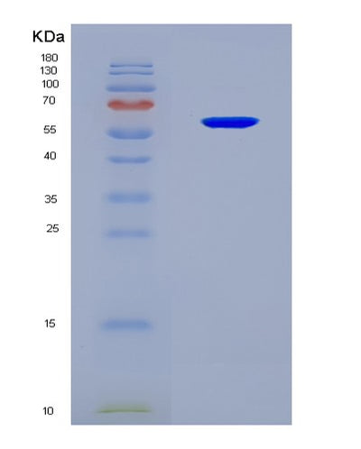 SDS-PAGE analysis of Human RBMY1A1 (Rna-Binding Motif Protein, Y Chromosome, Family 1 Member A1) - Recombinant Protein, CAT# BLT-08584P showing >90% purity under 15% SDS-PAGE (Reduced)Human RBMY1A1 (Rna-Binding Motif Protein, Y Chromosome, Family 1 Member A1) - Recombinant Protein
