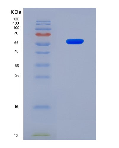 SDS-PAGE analysis of Mouse Membrane-associated tyrosine- and threonine-specific cdc2-inhibitory kinase (PKMYT1) - Recombinant Protein, CATMouse Membrane-associated tyrosine- and threonine-specific cdc2-inhibitory kinase (PKMYT1) - Recombinant Protein