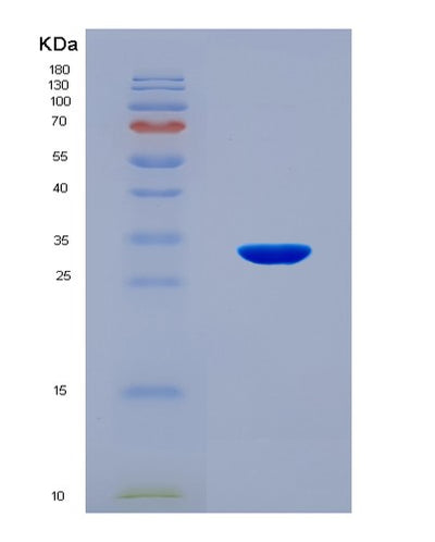 SDS-PAGE analysis of Mouse Gsk3b (Glycogen Synthase Kinase-3 Beta) - Recombinant Protein, CAT# BLT-08588P showing >90% purity under 15% SDS-PAGE (Reduced)Mouse Gsk3b (Glycogen Synthase Kinase-3 Beta) - Recombinant Protein