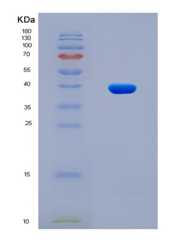 SDS-PAGE analysis of Mouse Hnrnpa1 (Heterogeneous Nuclear Ribonucleoprotein A1) - Recombinant Protein, CAT# BLT-08589P showing >90% purity under 15% SDS-PAGE (Reduced)Mouse Hnrnpa1 (Heterogeneous Nuclear Ribonucleoprotein A1) - Recombinant Protein