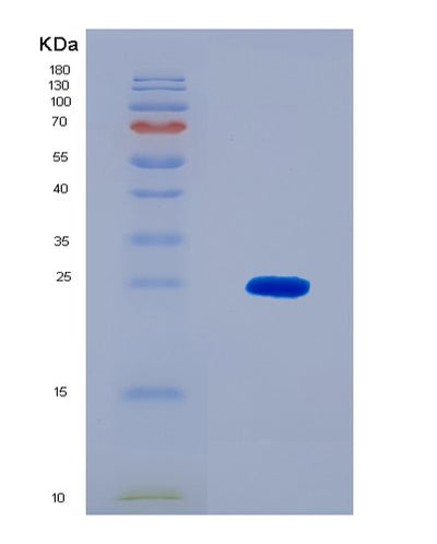 SDS-PAGE analysis of Human PCM1 (Pericentriolar Material 1 Protein) - Recombinant Protein, CAT# BLT-08592P showing >90% purity under 15% SDS-PAGE (Reduced)Human PCM1 (Pericentriolar Material 1 Protein) - Recombinant Protein