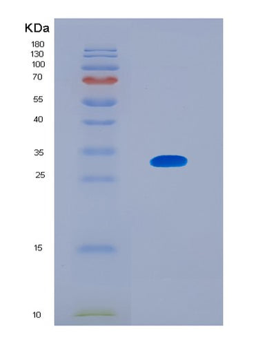 SDS-PAGE analysis of Human KIF1A (Kinesin-Like Protein Kif1A) - Recombinant Protein, CAT# BLT-08595P showing >90% purity under 15% SDS-PAGE (Reduced)Human KIF1A (Kinesin-Like Protein Kif1A) - Recombinant Protein