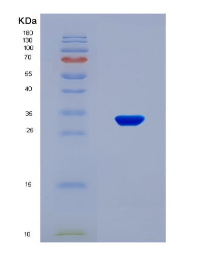 SDS-PAGE analysis of Human PXN (Paxillin) - Recombinant Protein, CAT# BLT-08597P showing >90% purity under 15% SDS-PAGE (Reduced)Human PXN (Paxillin) - Recombinant Protein
