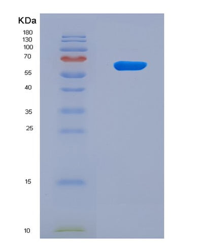 SDS-PAGE analysis of Human CYP26B1 (Cytochrome P450 26B1) - Recombinant Protein, CAT# BLT-08599P showing >90% purity under 15% SDS-PAGE (Reduced)Human CYP26B1 (Cytochrome P450 26B1) - Recombinant Protein