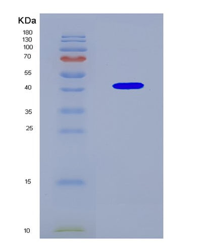 SDS-PAGE analysis of Human EGFR (Epidermal Growth Factor Receptor) - Recombinant Protein, CAT# BLT-08603P showing >90% purity under 15% SDS-PAGE (Reduced)Human EGFR (Epidermal Growth Factor Receptor) - Recombinant Protein