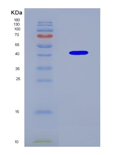SDS-PAGE analysis of Human EGFR (Epidermal Growth Factor Receptor) - Recombinant Protein, CATHuman EGFR (Epidermal Growth Factor Receptor) - Recombinant Protein