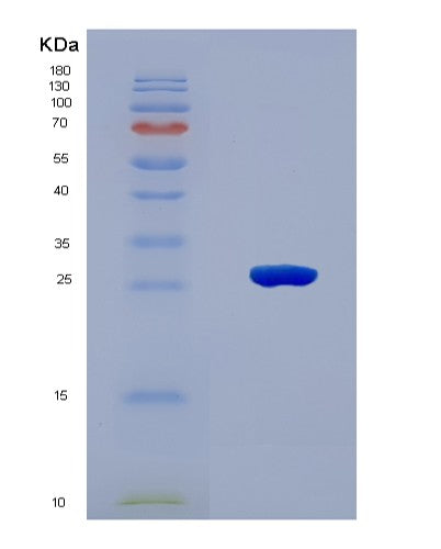 SDS-PAGE analysis of Human LAMB1 (Laminin Subunit Beta-1) - Recombinant Protein, CATHuman LAMB1 (Laminin Subunit Beta-1) - Recombinant Protein