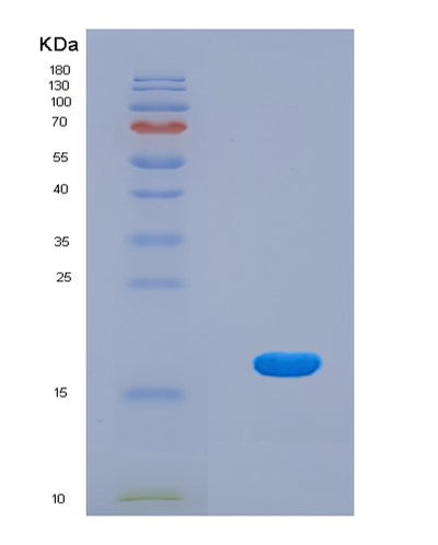 SDS-PAGE analysis of Human MASTL (Serine/Threonine-Protein Kinase Greatwall) - Recombinant Protein, CAT# BLT-08606P showing >90% purity under 15% SDS-PAGE (Reduced)Human MASTL (Serine/Threonine-Protein Kinase Greatwall) - Recombinant Protein