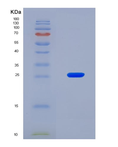 SDS-PAGE analysis of Mouse Vegfb (Vascular Endothelial Growth Factor B) - Recombinant Protein, CAT# BLT-08608P showing >90% purity under 15% SDS-PAGE (Reduced)Mouse Vegfb (Vascular Endothelial Growth Factor B) - Recombinant Protein