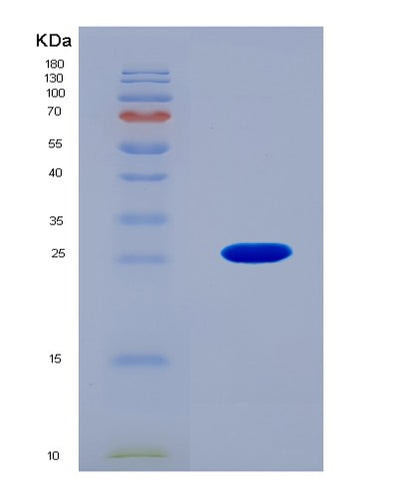 SDS-PAGE analysis of Mouse Grem1 (Gremlin-1) - Recombinant Protein, CAT# BLT-08609P showing >90% purity under 15% SDS-PAGE (Reduced)Mouse Grem1 (Gremlin-1) - Recombinant Protein