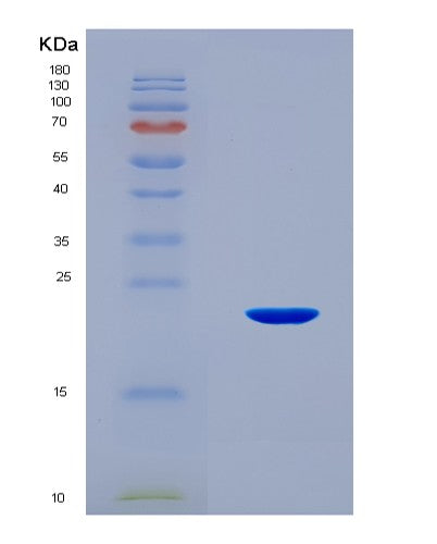 SDS-PAGE analysis of Human PAEP (Glycodelin) - Recombinant Protein, CATHuman PAEP (Glycodelin) - Recombinant Protein