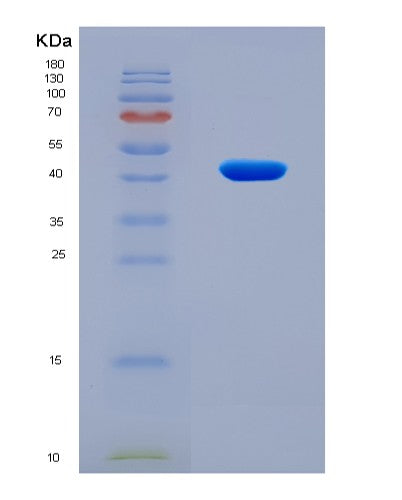 SDS-PAGE analysis of Human MAPK13 (Mitogen-Activated Protein Kinase 13) - Recombinant Protein, CATHuman MAPK13 (Mitogen-Activated Protein Kinase 13) - Recombinant Protein