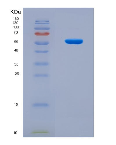 SDS-PAGE analysis of Mouse Nptx1 (Neuronal Pentraxin-1) - Recombinant Protein, CAT# BLT-08614P showing >90% purity under 15% SDS-PAGE (Reduced)Mouse Nptx1 (Neuronal Pentraxin-1) - Recombinant Protein