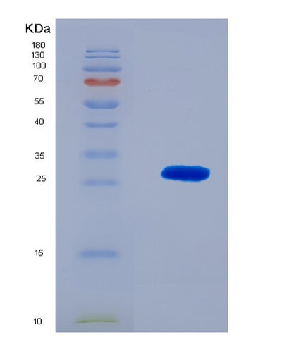 SDS-PAGE analysis of Human RSPO1 (R-Spondin-1) - Recombinant Protein, CAT# BLT-08615P showing >90% purity under 15% SDS-PAGE (Reduced)Human RSPO1 (R-Spondin-1) - Recombinant Protein