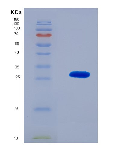 SDS-PAGE analysis of Human RSPO1 (R-Spondin-1) - Recombinant Protein, CATHuman RSPO1 (R-Spondin-1) - Recombinant Protein