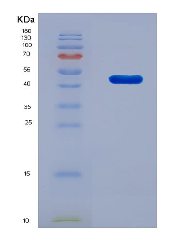 SDS-PAGE analysis of Human TARDBP (Tar Dna-Binding Protein 43) - Recombinant Protein, CAT# BLT-08616P showing >90% purity under 15% SDS-PAGE (Reduced)Human TARDBP (Tar Dna-Binding Protein 43) - Recombinant Protein