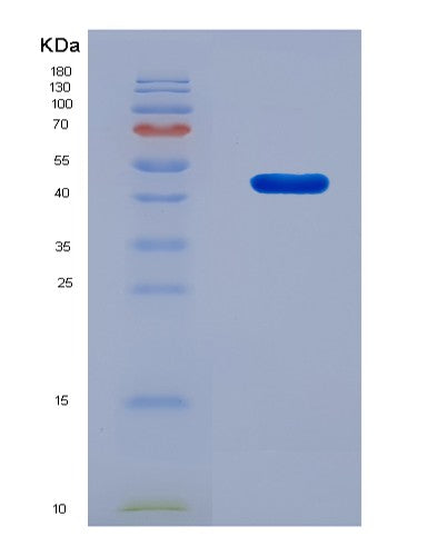SDS-PAGE analysis of Human TARDBP (Tar Dna-Binding Protein 43) - Recombinant Protein, CATHuman TARDBP (Tar Dna-Binding Protein 43) - Recombinant Protein