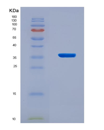 SDS-PAGE analysis of Human TARDBP (Tar Dna-Binding Protein 43) - Recombinant Protein, CAT# BLT-08617P showing >90% purity under 15% SDS-PAGE (Reduced)Human TARDBP (Tar Dna-Binding Protein 43) - Recombinant Protein
