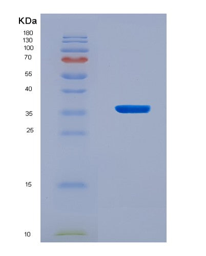 SDS-PAGE analysis of Human TARDBP (Tar Dna-Binding Protein 43) - Recombinant Protein, CATHuman TARDBP (Tar Dna-Binding Protein 43) - Recombinant Protein