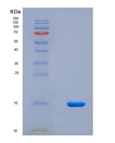 SDS-PAGE analysis of Human PLA2G5 (Phospholipase A2 Group V) - Recombinant Protein, CAT# BLT-08618P showing >90% purity under 15% SDS-PAGE (Reduced)Human PLA2G5 (Phospholipase A2 Group V) - Recombinant Protein