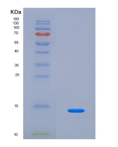 SDS-PAGE analysis of Human PLOD1 (Procollagen-Lysine,2-Oxoglutarate 5-Dioxygenase 1) - Recombinant Protein, CAT# BLT-08620P showing >90% purity under 15% SDS-PAGE (Reduced)Human PLOD1 (Procollagen-Lysine,2-Oxoglutarate 5-Dioxygenase 1) - Recombinant Protein