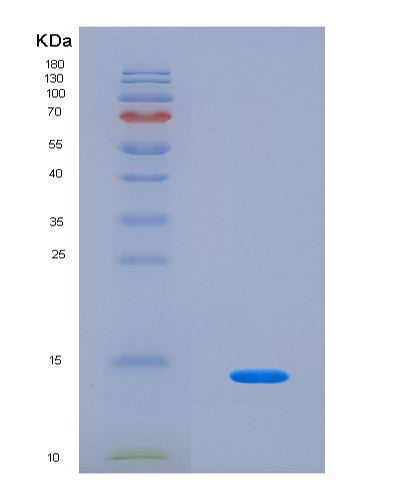 SDS-PAGE analysis of Human PLOD1 (Procollagen-Lysine,2-Oxoglutarate 5-Dioxygenase 1) - Recombinant Protein, CATHuman PLOD1 (Procollagen-Lysine,2-Oxoglutarate 5-Dioxygenase 1) - Recombinant Protein