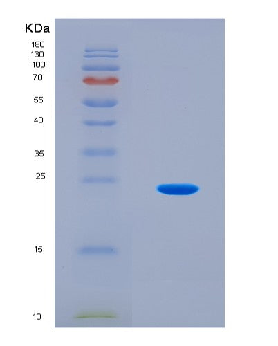 SDS-PAGE analysis of Human UBA6 (Ubiquitin-Like Modifier-Activating Enzyme 6) - Recombinant Protein, CATHuman UBA6 (Ubiquitin-Like Modifier-Activating Enzyme 6) - Recombinant Protein